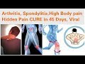 Arthritis | Spondylitis | High Body Pain Cure in 45 days | Hidden Pain | Viral | Dr Shalini