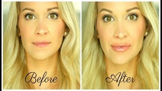 How To Get Bigger Lips Without Injections Juvalips Review