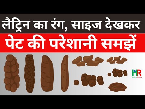 वीडियो: सामान्य कंधे की पट्टियाँ: रंग और कंधे की पट्टियों के प्रकार