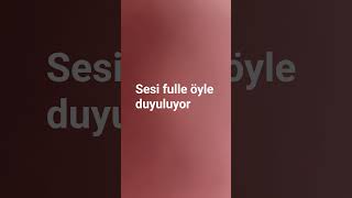 #akmkikitnigholiyonmeenemymartahai #ytdayibenionecikarnolur #itzy #muhasebebilenlertoplulugu #lovexx