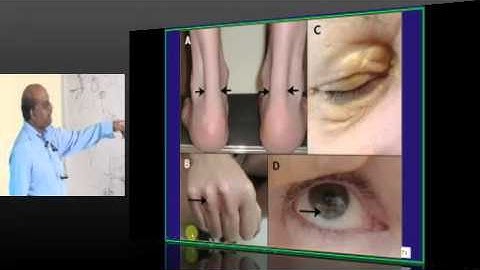 NEETPG Coaching Image Based MCQ