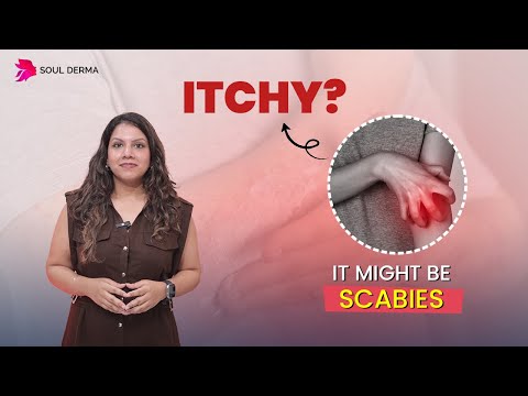 Scabies Explained: Causes, Symptoms & Treatment by Dermatologist