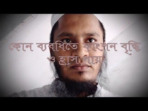 ভিডিও: কিভাবে রুবি কিনবেন (ছবি সহ)