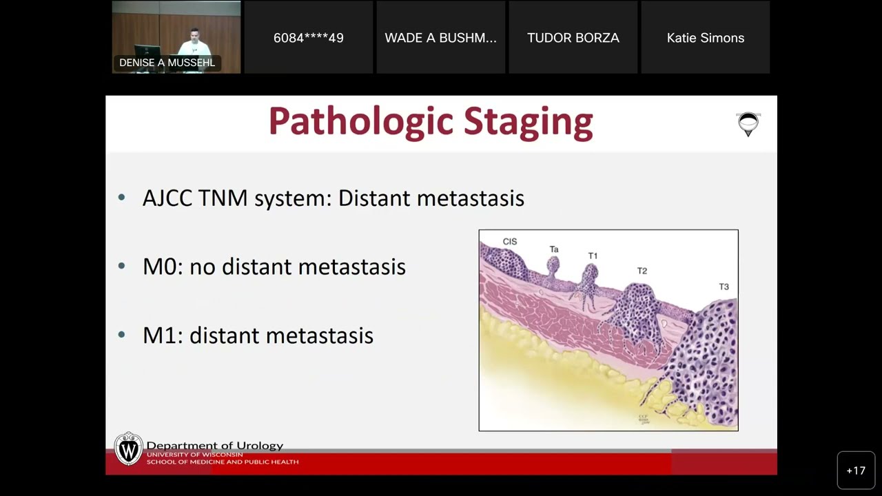 UW Urology Grand Rounds:  Muscle Invasive Bladder Cancer State of the Art – 9/7/2022
