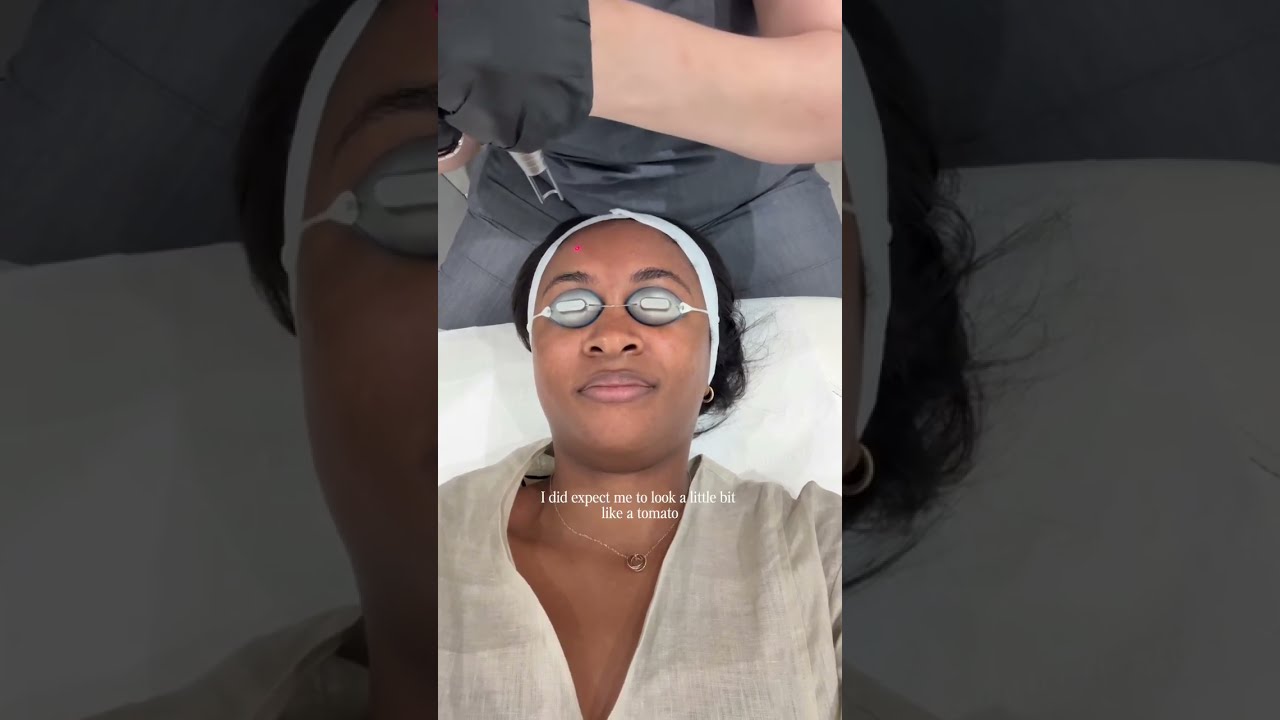 here’s my review of Skin Laundry - specialising in laser treatments