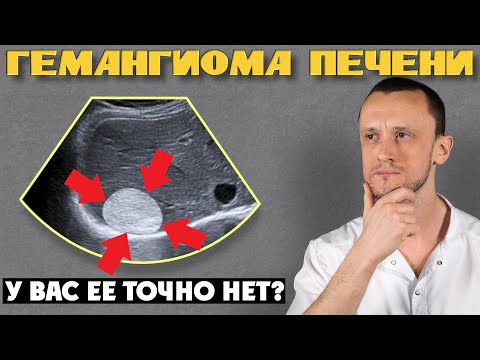 Гемангиома печени | Лечение