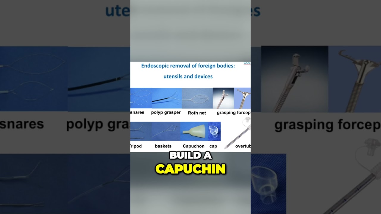 Endoscopic removal of foreign bodies: utensils and devices