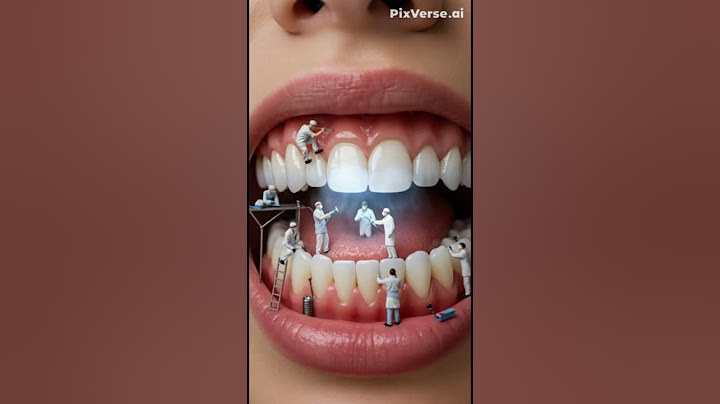 "Tiny Workers Fixing Teeth Like a Mega Construction Site! 🦷🤖  #shortvideo