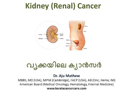 വൃക്കയിലെ ക്യാന്സര് Kidney Cancer