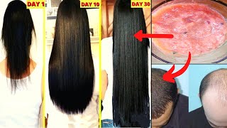 100% Natural Hair Loss Treatment, Cure Baldness, Grow Long Hair| Remove Dandruff Thin Hair Hair Fall