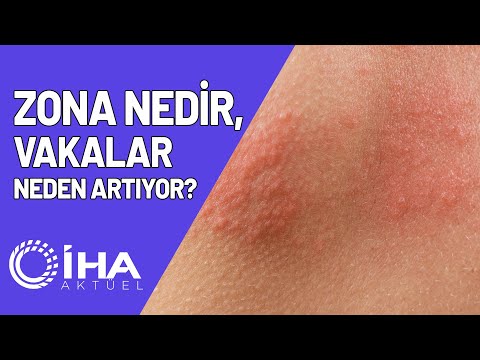 Zona Nedir Vakalar Neden Artıyor