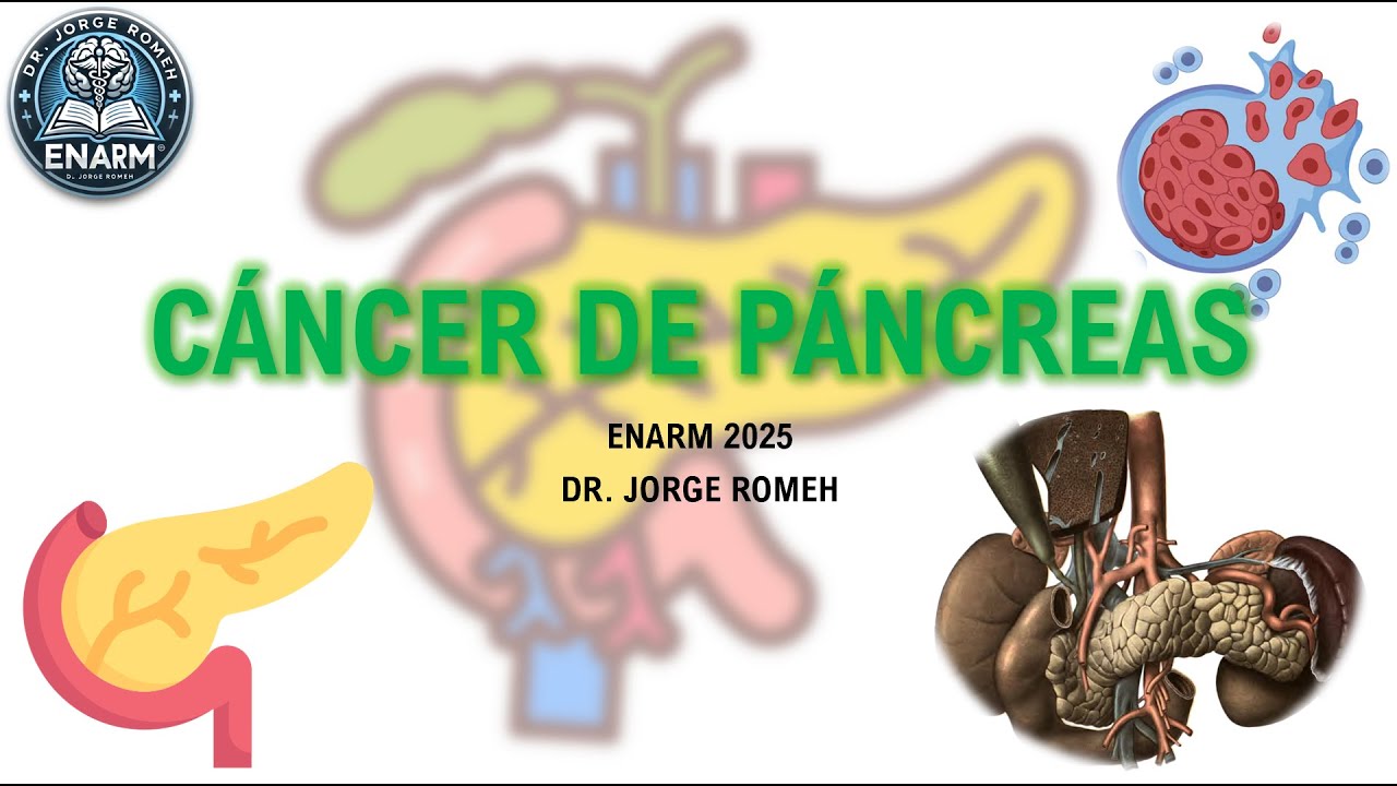 CÁNCER DE PÁNCREAS - ENARM 2025 - TODO LO QUE DEBES SABER