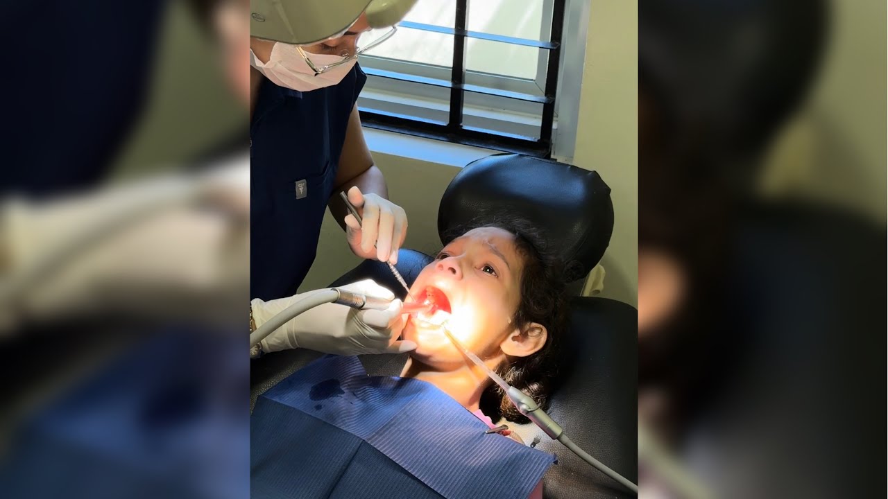 PinaDentist namin ulit si Duday, naiyak sya HAHAHAH