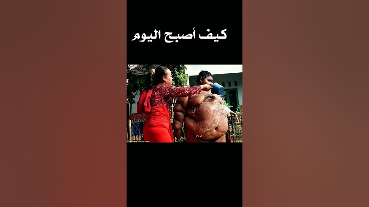 أسمن طفل في العالم في العالم يصنع المعجزات في إزالة وزنه بوقت قياسي 😱😱😱😱😱
