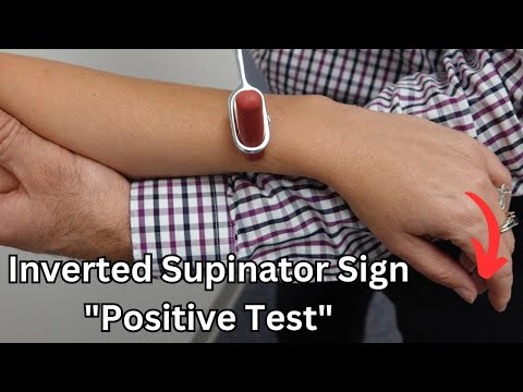 Inverted Supinator Sign (Upper Motor Neuron Lesion)