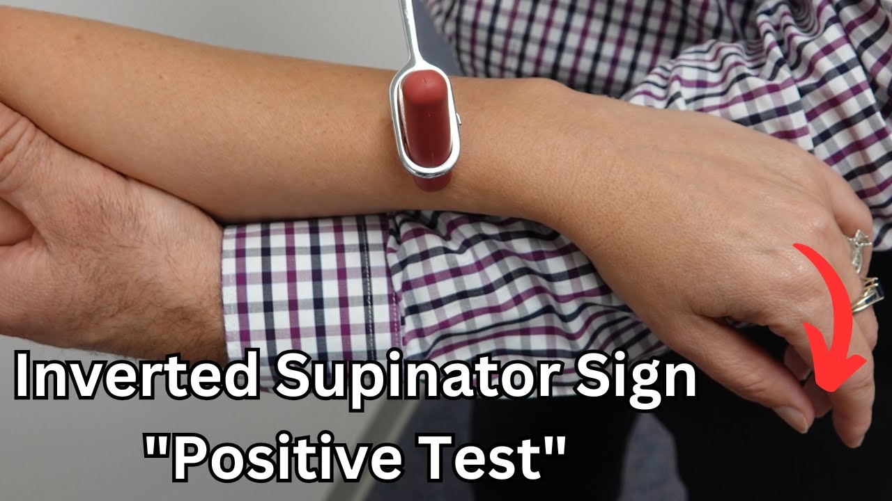 Inverted Reflex Inverted Supinator Sign (Upper Motor Neuron Lesion) - YouTube