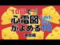 【10日で心電図がよめる】10日目 (最終日) 演習+α