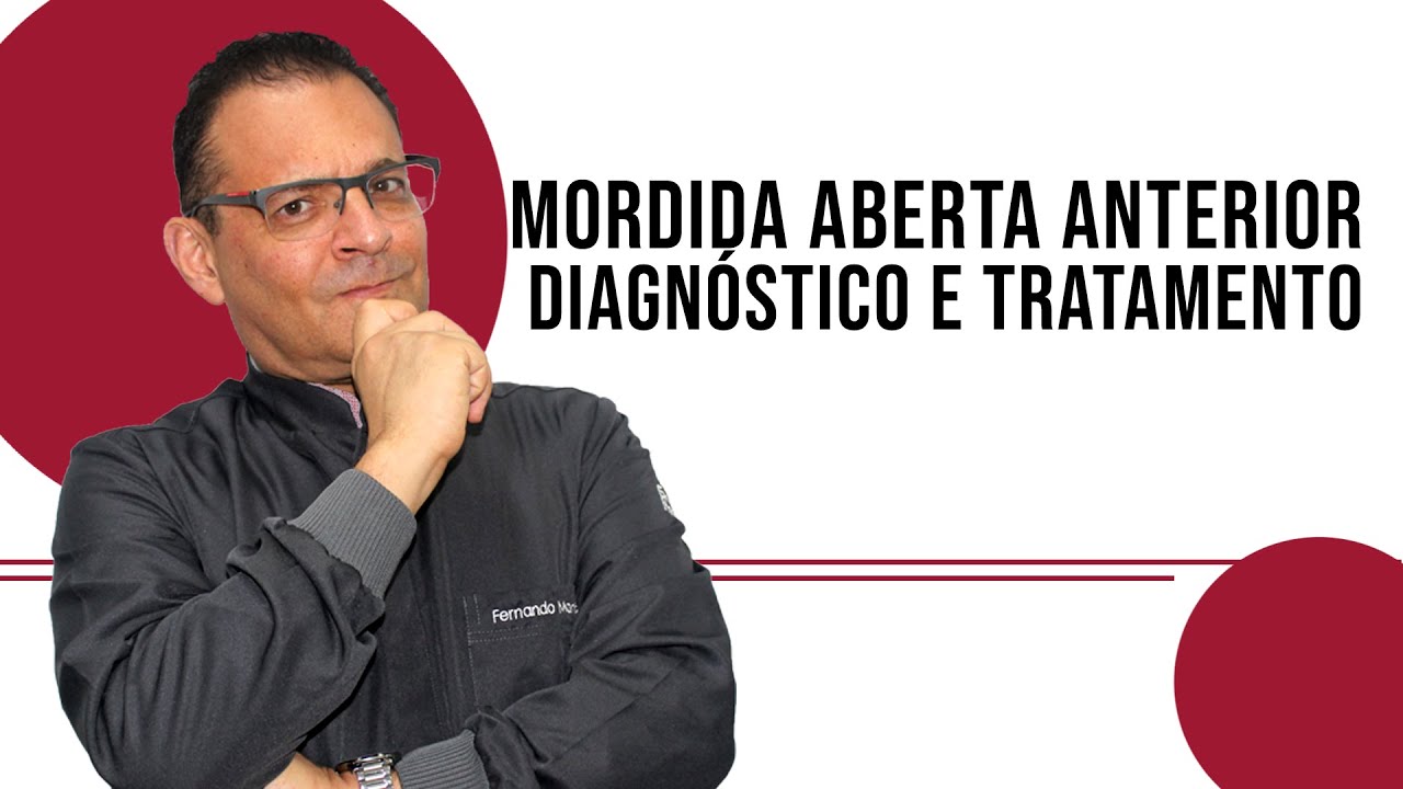 MORDIDA ABERTA ANTERIOR DIAGNÓSTICO E TRATAMENTO