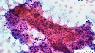 Normal salivary gland cytology