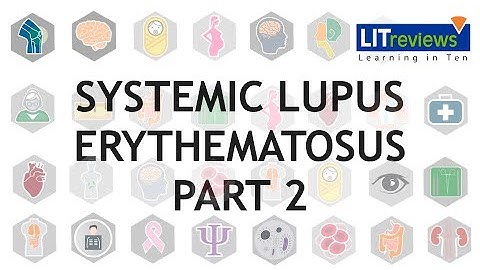 Systemic Lupus Erythematosus Part 2