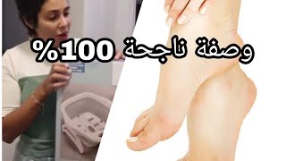 كارولين: وصفة تبييض الارجل مضمونة 100%?