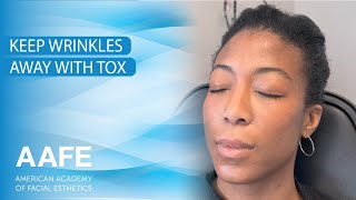 Keep Wrinkles Away with Tox