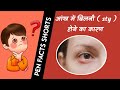 आँख की बिलनी को कैसे ठीक करे।