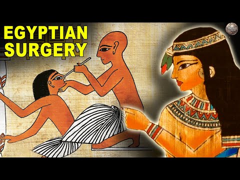 고대 이집트의 수술은 어땠습니까?