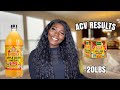 How I Lost 20lbs In 3 Weeks With Apple Cider Vinegar: Results