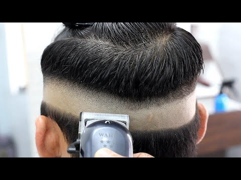 Video: Cara Menghentikan Garis Rambut Yang Menurun: Opsi Perawatan
