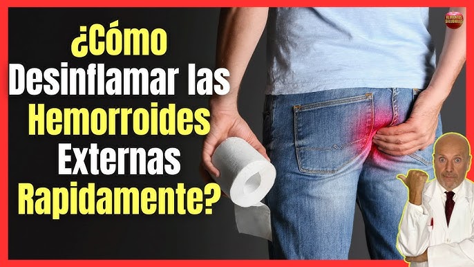 aceite de coco para hemorroides 12 hq720