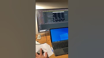 Wireless and audible real-time R-peak detection