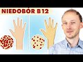 Niedobór witaminy B12: ukryta przyczyna chorób i dolegliwości! Witamina B12 | Dr Bartek Kulczyński