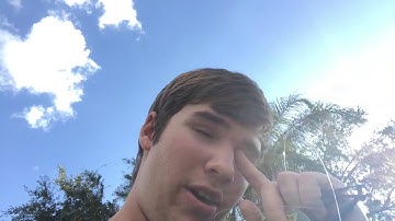 How to fix holes in your castnet