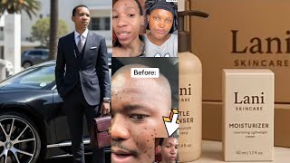 Dr Matthew Lani does it again,he breaks the internet with his skincare range,fans start a Lani chall
