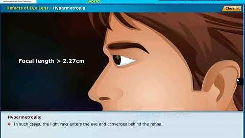 Defects of Eye, Human Eye Colourful world Class 10 Physics