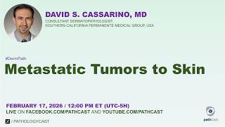 #DERMPATH Metastatic Tumors to Skin