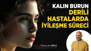 Kalın burun derili hastalarda iyileşme süreci.