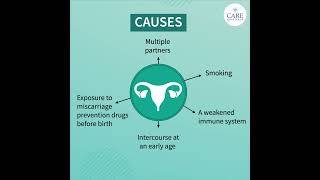 Things You Need to Know About Cervical Cancer | CARE Hospitals