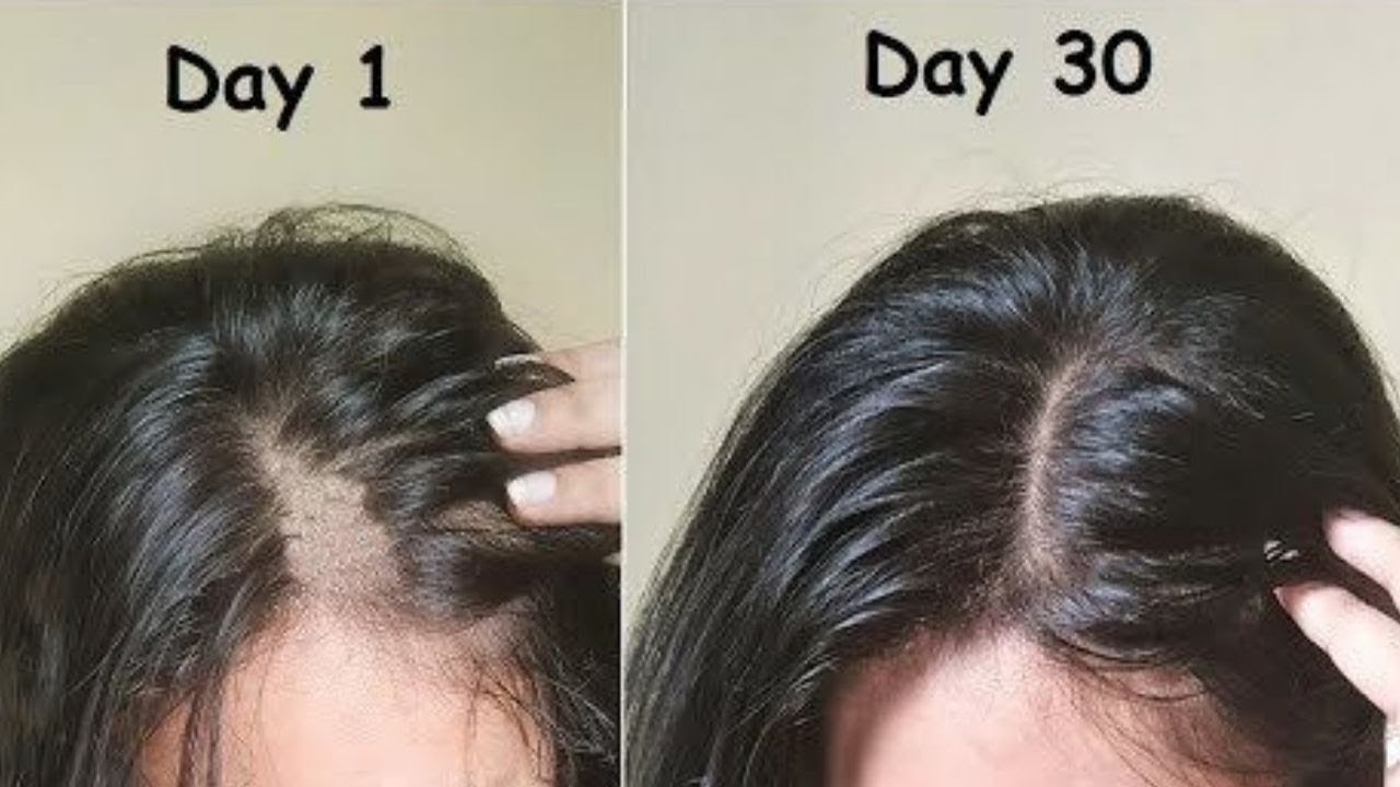 नय बल उगन क 5 घरल उपय ज ददनन क समय स ह करगर  Nani ke  nuskhe How to regrow hair naturally in hindi