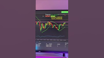 Live Trade Execution on Abbado: 100 Points Profit!