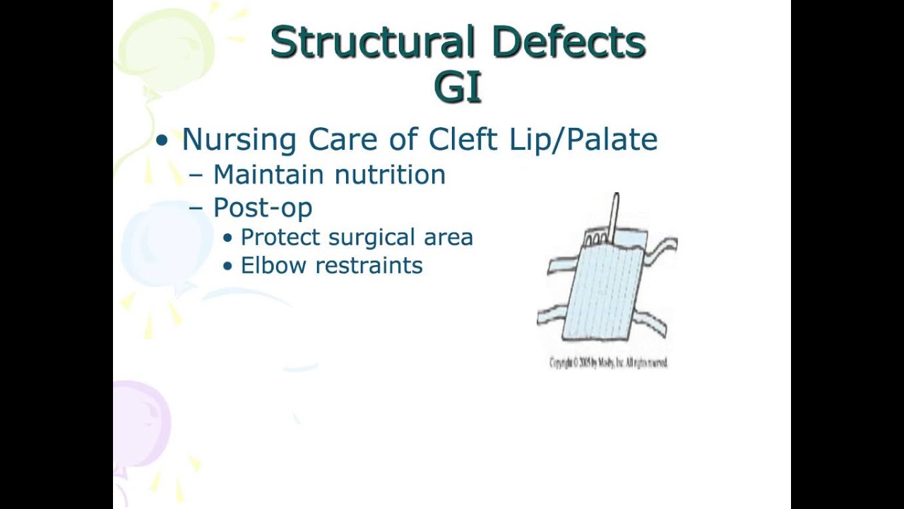 Gf unit 5 lecture 4 structural defects YouTube
