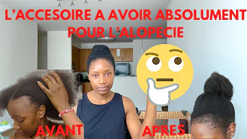 Quelle coupe de cheveux pour perte de cheveux