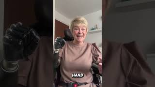 Amputation isn't the end of movement It's the beginning of innovation & bionics