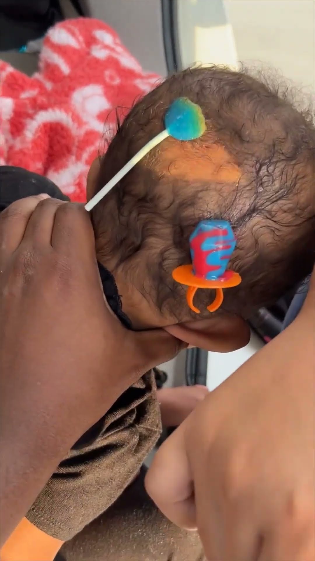 Baby Ends Up with Lollipops Stuck to Head During Diaper Change