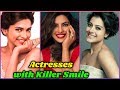 10 Actresses Who Have Most Beautiful Smile