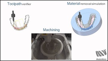 ModuleWorks Dental Framework - 3 Plus 2 Undercut Machining