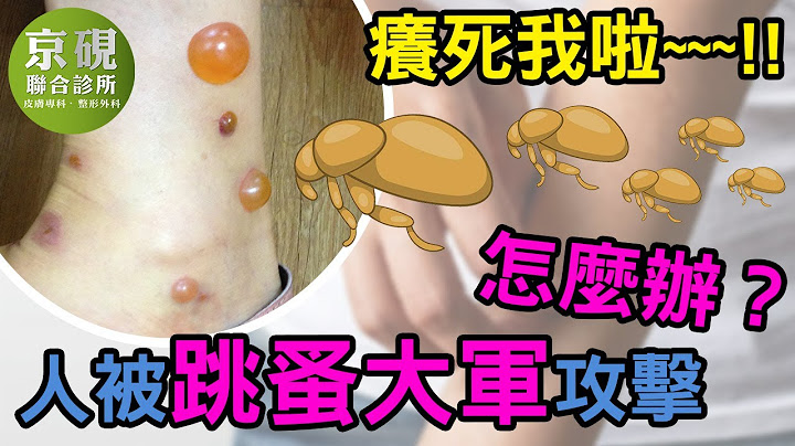 人被跳蚤大军攻击怎么办？痒死我啦~~~!!【京砚皮肤科诊所】 - 天天要闻