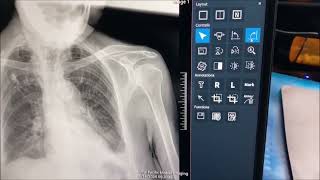 Editing X-ray image screenshot 5