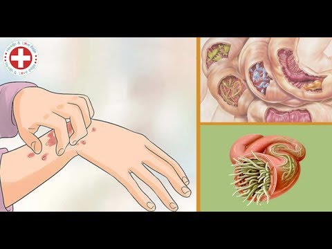 10 Herbs that Naturally Kill Parasites in Humans camera iphone 8 plus apk